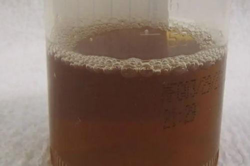 尿图片,解读尿液颜色、气味与形态